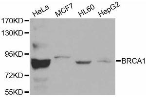 Western blot analysis of extracts of various cell lines, using BRCA1 antibody (ABIN5970045). (BRCA1 Antikörper)