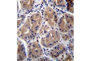 Immunohistochemistry (Paraffin-embedded Sections) (IHC (p)) image for anti-RAB27B, Member RAS Oncogene Family (RAB27B) (AA 128-158), (Middle Region) antibody (ABIN954410)