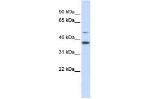 Western Blotting (WB) image for anti-Methylmalonic Aciduria (Cobalamin Deficiency) CblD Type, with Homocystinuria (MMADHC) antibody (ABIN2459880) (MMADHC Antikörper)