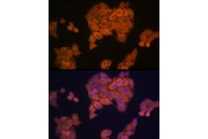 Immunofluorescence analysis of HeLa cells using PMP70/ Rabbit mAb (ABIN1683181, ABIN3018647, ABIN3018648 and ABIN7101638) at dilution of 1:100 (40x lens). (CX3CL1 Antikörper)