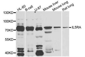 Western blot analysis of extracts of various cell lines, using IL5RA antibody (ABIN5996447) at 1/1000 dilution. (IL5RA Antikörper)