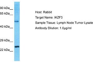 Host: Rabbit Target Name: IKZF3 Sample Type: Lymph Node Tumor lysates Antibody Dilution: 1. (IKZF3 Antikörper  (Middle Region))