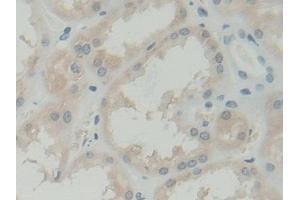 Detection of BLVRB in Human Kidney Tissue using Polyclonal Antibody to Biliverdin Reductase B (BLVRB) (BLVRB Antikörper  (AA 2-206))