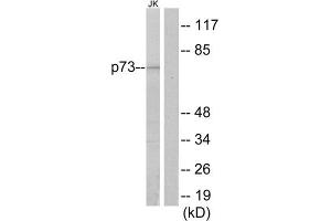 Western Blotting (WB) image for anti-Tumor Protein P73 (TP73) (Internal Region) antibody (ABIN1848961) (Tumor Protein p73 Antikörper  (Internal Region))