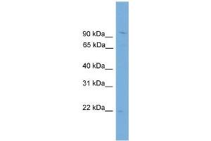 Human THP-1; WB Suggested Anti-TPPP3 Antibody Titration: 0.