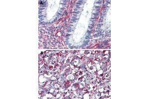 Immunohistochemical staining of formalin-fixed, paraffin-embedded human uterus (A) and human adrenal gland (B) tissue after heat-induced antigen retrieval. (Angiotensin II Type 2 Receptor Antikörper  (Internal Region))