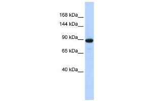 PDE3A antibody used at 1 ug/ml to detect target protein. (PDE3A Antikörper  (N-Term))
