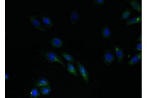 Immunofluorescent analysis of HepG2 cells using ABIN7151168 at dilution of 1:100 and Alexa Fluor 488-congugated AffiniPure Goat Anti-Rabbit IgG(H+L)
