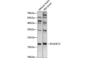 Western blot analysis of extracts of various cell lines, using RN antibody (ABIN7269985) at 1:1000 dilution. (RNASE12 Antikörper  (AA 1-100))