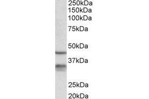 Western Blotting (WB) image for anti-Hydroxysteroid (11-Beta) Dehydrogenase 1 (HSD11B1) (Internal Region) antibody (ABIN2464932) (HSD11B1 Antikörper  (Internal Region))