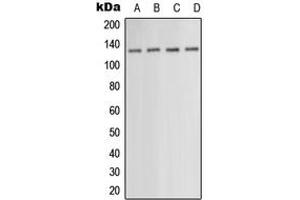 Western blot analysis of PKN1 expression in HEK293T (A), HepG2 (B), SP2/0 (C), NIH3T3 (D) whole cell lysates. (PKN1 Antikörper  (Center))