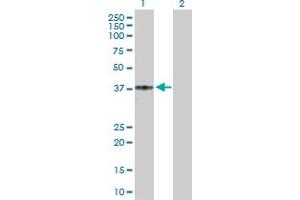 Western Blot analysis of CCR5 expression in transfected 293T cell line by CCR5 MaxPab polyclonal antibody. (CCR5 Antikörper  (AA 1-352))