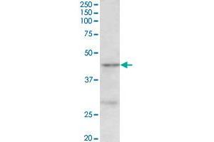 PRMT6 polyclonal antibody  (0. (PRMT6 Antikörper  (Internal Region))