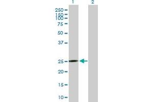 Western Blot analysis of MRPS10 expression in transfected 293T cell line by MRPS10 MaxPab polyclonal antibody. (MRPS10 Antikörper  (AA 1-201))