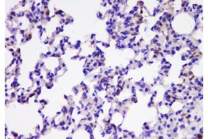 IHC analysis of TIMM17A using anti-TIMM17A antibody (ABIN6719637). (TIMM17A Antikörper)