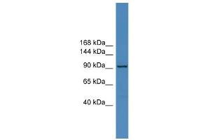 WB Suggested Anti-ZNF574 Antibody Titration:  0. (ZNF574 Antikörper  (C-Term))