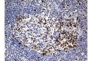 Image no. 6 for anti-Antigen Identified By Monoclonal Antibody Ki-67 (MKI67) (AA 1160-1493) antibody (ABIN1490857) (Ki-67 Antikörper  (AA 1160-1493))