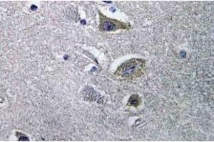 Immunohistochemistry (IHC) analyzes of NDUFV2 antibody in paraffin-embedded human brain tissue. (NDUFV2 Antikörper)