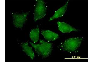 Immunofluorescence of purified MaxPab antibody to EIF4ENIF1 on HeLa cell. (EIF4ENIF1 Antikörper  (AA 1-985))