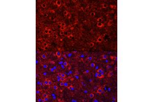 Immunofluorescence analysis of mouse brain cells using NTRK3 Rabbit pAb (ABIN6132429, ABIN6144910, ABIN6144912 and ABIN6221540) at dilution of 1:100 (40x lens). (NTRK3 Antikörper  (AA 40-300))