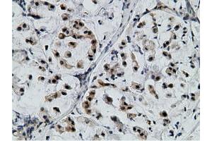 Image no. 1 for anti-EPM2A (Laforin) Interacting Protein 1 (EPM2AIP1) antibody (ABIN1498047) (EPM2AIP1 Antikörper)