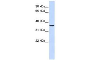 Image no. 1 for anti-Fructose-1,6-Bisphosphatase 2 (FBP2) (AA 216-265) antibody (ABIN6741005) (FBP2 Antikörper  (AA 216-265))