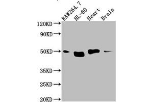 Western Blot Positive WB detected in: RAW264. (Rekombinanter TINF2 Antikörper)