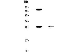 Western blot analysis of Bcl-2 using anti-Bcl-2 antibody . (Bcl-2 Antikörper  (AA 118-165))
