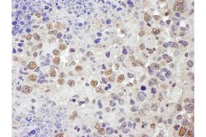 Immunohistochemistry (IHC) image for anti-Tripartite Motif Containing 33 (TRIM33) (AA 650-700) antibody (ABIN7453470)