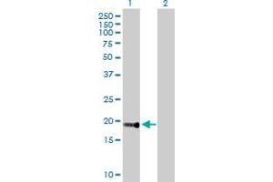 Western Blot analysis of DDIT4L expression in transfected 293T cell line by DDIT4L MaxPab polyclonal antibody.