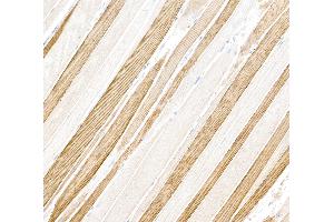 Immunohistochemistry (IHC) image for anti-Myosin, Light Chain 1, Alkali, Skeletal, Fast (MYL1) (Light Chain) antibody (ABIN7795615)