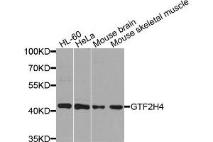 Western blot analysis of extracts of various cell lines, using GTF2H4 antibody. (GTF2H4 Antikörper)