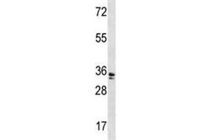WDR5 antibody western blot analysis in A2058 lysate. (WDR5 Antikörper  (AA 12-40))