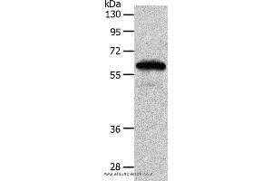 Western blot analysis of Mouse brain tissue, using INA Polyclonal Antibody at dilution of 1:550 (INA Antikörper)