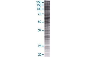 Western Blotting (WB) image for CES1 293T Cell Transient Overexpression Lysate(Denatured) (ABIN1331328)