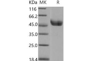 Western Blotting (WB) image for Renin (REN) (Active) protein (His tag) (ABIN7320334) (Renin Protein (REN) (His tag))