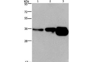 Western Blot analysis of Human breast infiltRative duct and fetal brain tissue, Mouse brain tissue using CUEDC2 Polyclonal Antibody at dilution of 1:600 (CUEDC2 Antikörper)
