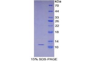 SDS-PAGE (SDS) image for S100 Calcium Binding Protein A8 (S100A8) (AA 1-89) protein (His tag) (ABIN1080748) (S100A8 Protein (AA 1-89) (His tag))