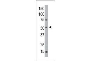 Western blot analysis of anti-hMGAT1- Pab (ABIN389036 and ABIN2839251) in Y79 cell line lysate. (MGAT1 Antikörper  (C-Term))