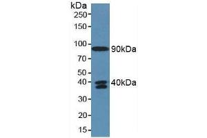 Detection of C4a in Human Serum using Polyclonal Antibody to Complement Component 4a (C4a) (C4A Antikörper  (AA 680-756))