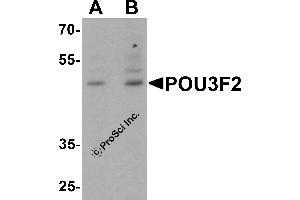 Western Blotting (WB) image for anti-POU Class 3 Homeobox 2 (POU3F2) (C-Term) antibody (ABIN1077394) (POU3F2 Antikörper  (C-Term))