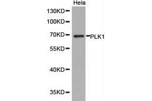 Western Blotting (WB) image for anti-Polo-Like Kinase 1 (PLK1) antibody (ABIN1874166) (PLK1 Antikörper)