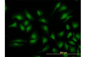 Immunofluorescence of monoclonal antibody to MAPK3 on HeLa cell. (ERK1 Antikörper  (AA 279-379))