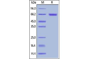 Biotinylated Human / Cynomolgus / Rhesus macaque ROR1, His,Avitag on  under reducing (R) condition. (ROR1 Protein (AA 30-403) (His tag,AVI tag,Biotin))