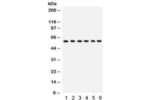 Western blot testing of 1) rat thymus, 2) rat lung, 3) HeLa, 4) 22RV1, 5) A431 and 6) mouse HEPA lysate with CYP24A1 antibody. (CYP24A1 Antikörper  (AA 153-514))