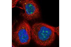 Immunofluorescent staining of human cell line A-431 with SOX7 polyclonal antibody  at 1-4 ug/mL shows positivity in nucleus, nucleoli and vesicles. (PINX1 Antikörper)