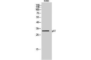 Western Blotting (WB) image for anti-P57 (Ser238) antibody (ABIN3176740) (P57 (Ser238) Antikörper)