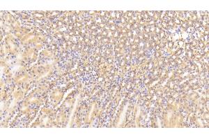 Detection of C3a in Mouse Kidney Tissue using Polyclonal Antibody to Complement Component 3a (C3a) (C3a Antikörper  (AA 671-748))