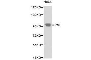 Western Blotting (WB) image for anti-Promyelocytic Leukemia (PML) antibody (ABIN1874171) (PML Antikörper)