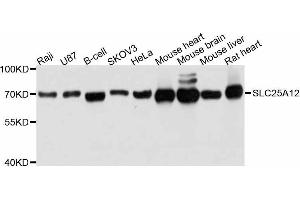 Western Blotting (WB) image for anti-Solute Carrier Family 25 (Mitochondrial Carrier, Aralar), Member 12 (Slc25a12) (AA 1-180) antibody (ABIN6147905)